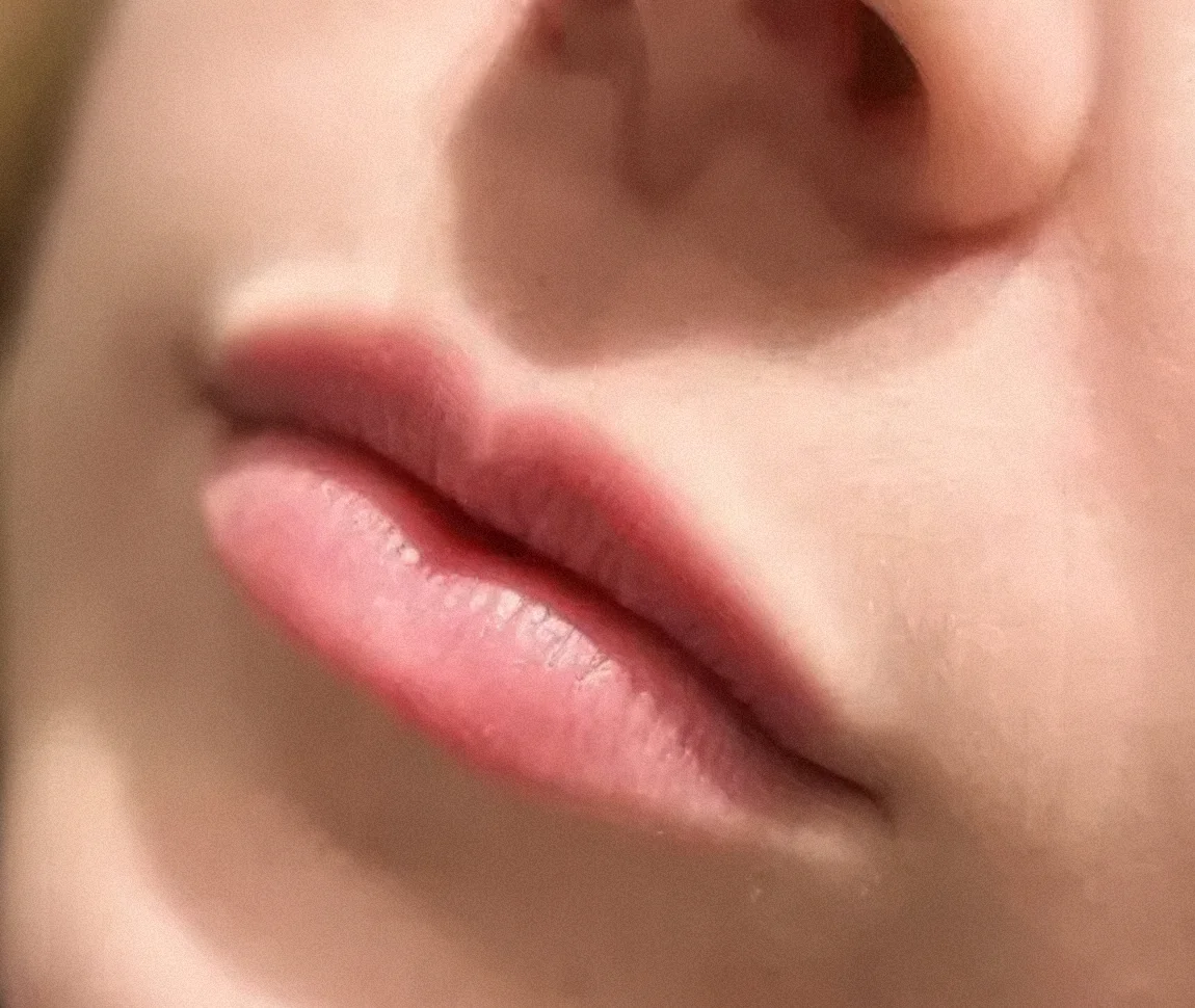 Lips before dermal filler treatment